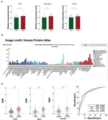 The SFT2D2 gene is associated with the autoimmune pathology of schizophrenia in a Chinese population